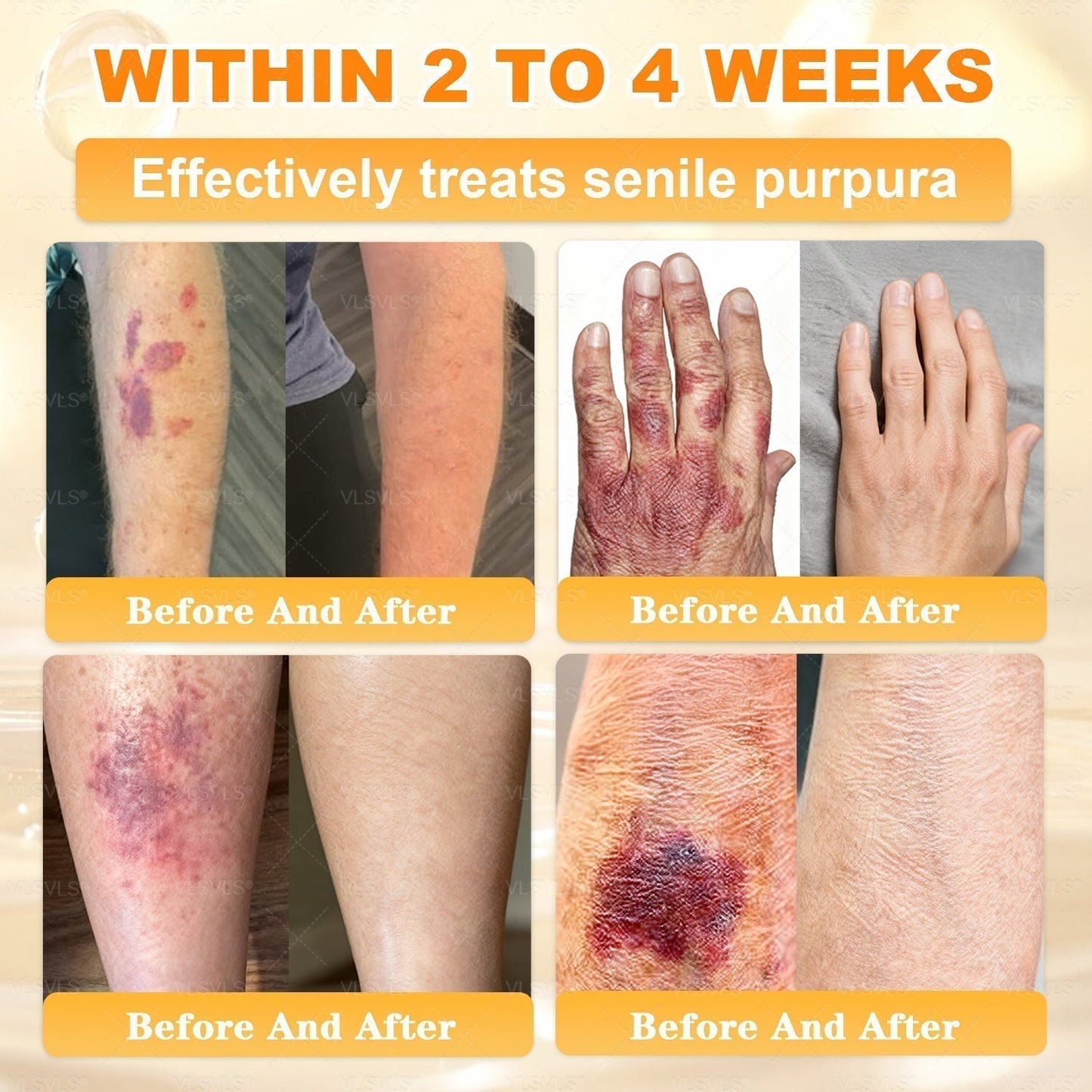 🔥 DERNIER JOUR – 80 % DE RÉDUCTION 🔥Crème Réparatrice pour la Peau au Venin d’Abeille