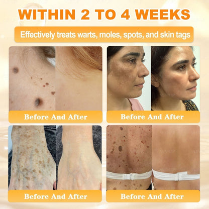 🔥 DERNIER JOUR – 80 % DE RÉDUCTION 🔥Crème Réparatrice pour la Peau au Venin d’Abeille