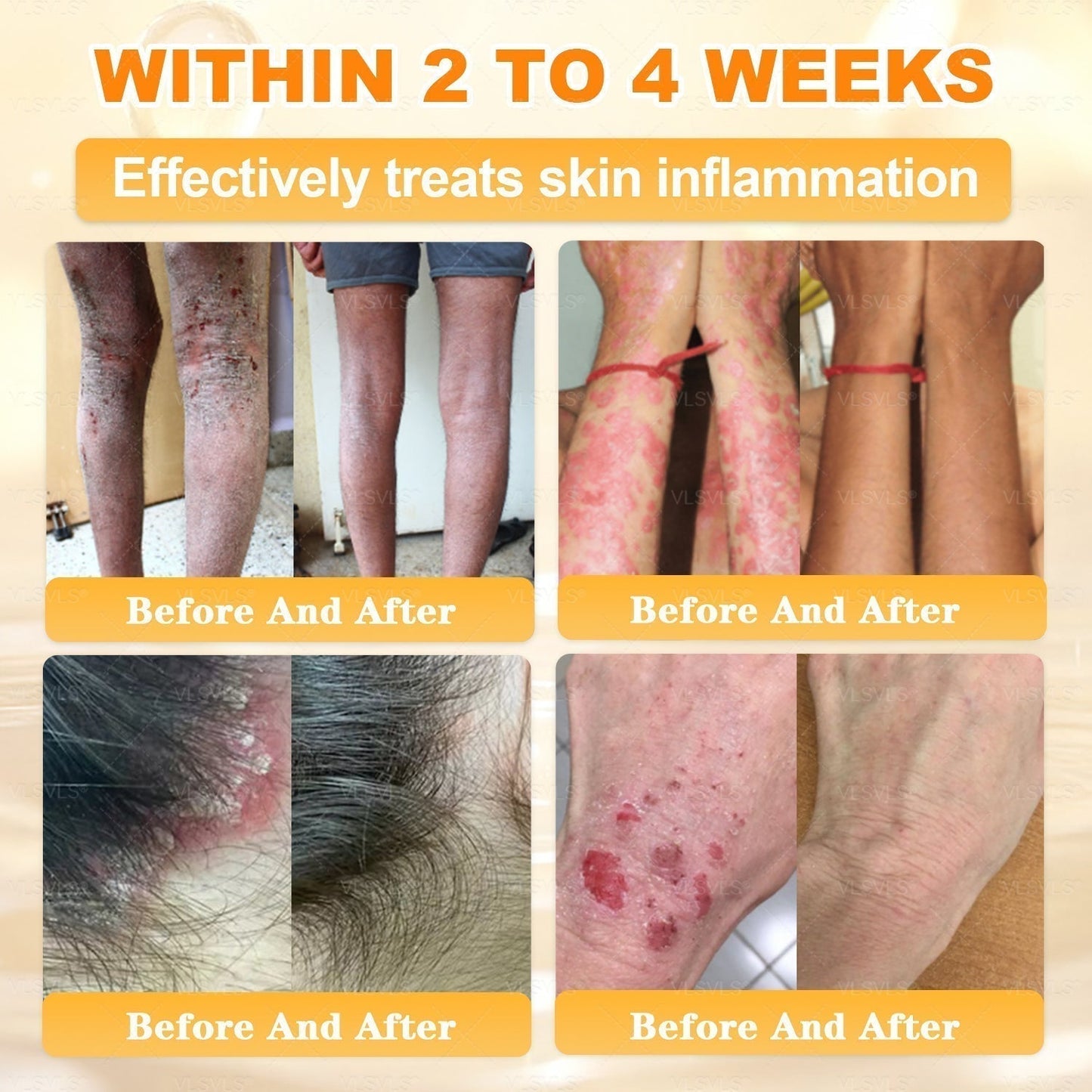 🔥 DERNIER JOUR – 80 % DE RÉDUCTION 🔥Crème Réparatrice pour la Peau au Venin d’Abeille